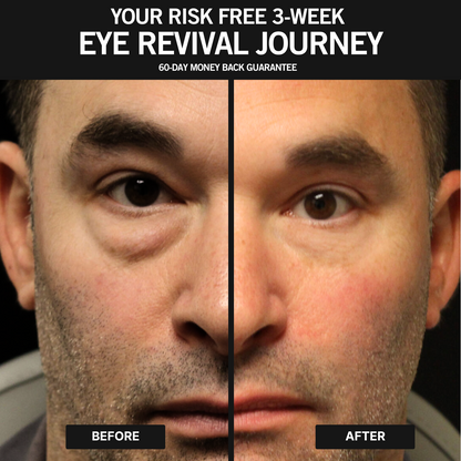 Zevorify Energizing Eye Masks