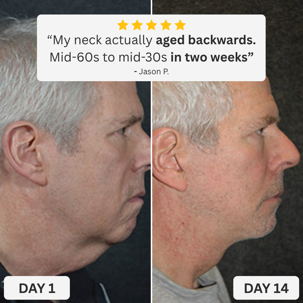 Zevorify Neck Repair Tallow Balm