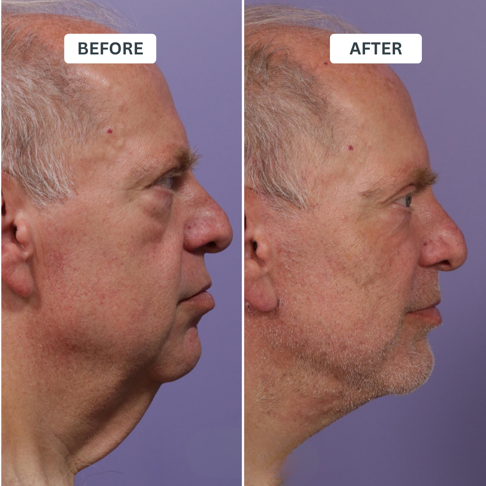 Zevorify Neck Repair Tallow Balm