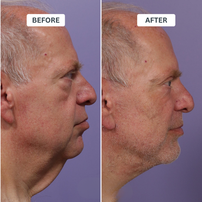 Zevorify Neck Repair Tallow Balm