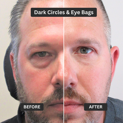 Zevorify Eye Repair Stick 2 Pack